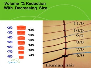 Volume  % Reduction  With  Decreasing  Size 2/0 3/0 4/0 5/0 6/0 7/0 8/0 2/0 3/0 4/0 5/0 6/0 7/0 8/0 51% 40% 49% 54% 50% 44% 51% 40% 49% 54% 50% 44% 