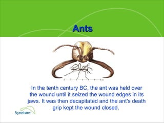 In the tenth century BC, the ant was held over the wound until it seized the wound edges in its jaws. It was then decapitated and the ant's death grip kept the wound closed.  Ants 