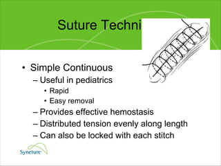 Suture Techniques Simple Continuous Useful in pediatrics Rapid Easy removal Provides effective hemostasis Distributed tension evenly along length Can also be locked with each stitch 