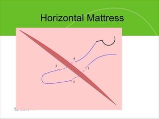 Horizontal Mattress 