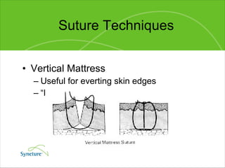Suture Techniques Vertical Mattress Useful for everting skin edges “ Far-far-near-near” 