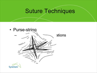 Suture Techniques Purse-string Useful for stellate lacerations 