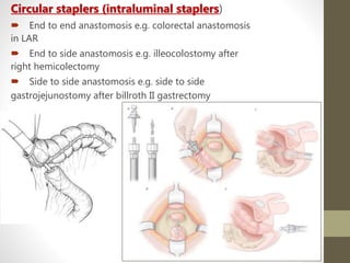 Circular staplers (intraluminal staplers)
 End to end anastomosis e.g. colorectal anastomosis
in LAR
 End to side anastomosis e.g. illeocolostomy after
right hemicolectomy
 Side to side anastomosis e.g. side to side
gastrojejunostomy after billroth II gastrectomy
 