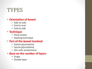 3
5
TYPES
• Orientation of bowel
• Side-to-side
• End-to-end
• End-to-side
• Technique
• Hand sewed
• Stapling technique
• Part of the bowel involved
• Gastro-jejunostomy
• Jejuno-jejunostomy
• Ileo-colic anastomosis
• Base on the number of layers
• Single
• Double layer
 