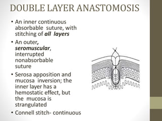 DOUBLE LAYER ANASTOMOSIS
• An inner continuous
absorbable suture, with
stitching of all layers
• An outer,
seromuscular,
interrupted
nonabsorbable
suture
• Serosa apposition and
mucosa inversion; the
inner layer has a
hemostatic effect, but
the mucosa is
strangulated
• Connell stitch- continuous
 