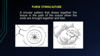 How To String Suture SUTURES AND SUTURING TECHNIQUES BY DR GOURAV | PPTX