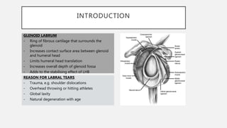 INTRODUCTION
GLENOID LABRUM
- Ring of fibrous cartilage that surrounds the
glenoid
- Increases contact surface area between glenoid
and humeral head
- Limits humeral head translation
- Increases overall depth of glenoid fossa
- Adds to the stabilising effect of LHB
REASON FOR LABRAL TEARS
- Trauma, e.g. shoulder dislocations
- Overhead throwing or hitting athletes
- Global laxity
- Natural degeneration with age
 