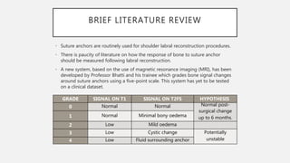 BRIEF LITERATURE REVIEW
• Suture anchors are routinely used for shoulder labral reconstruction procedures.
• There is paucity of literature on how the response of bone to suture anchor
should be measured following labral reconstruction.
• A new system, based on the use of magnetic resonance imaging (MRI), has been
developed by Professor Bhatti and his trainee which grades bone signal changes
around suture anchors using a five-point scale. This system has yet to be tested
on a clinical dataset.
GRADE SIGNAL ON T1 SIGNAL ON T2FS HYPOTHESIS
0 Normal Normal Normal post-
surgical change
up to 6 months.1 Normal Minimal bony oedema
2 Low Mild oedema
3 Low Cystic change Potentially
unstable4 Low Fluid surrounding anchor
 