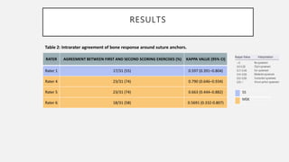 RESULTS
RATER AGREEMENT BETWEEN FIRST AND SECOND SCORING EXERCISES (%) KAPPA VALUE (95% CI)
Rater 1 17/31 (55) 0.597 (0.391–0.804)
Rater 4 23/31 (74) 0.790 (0.646–0.934)
Rater 5 23/31 (74) 0.663 (0.444–0.882)
Rater 6 18/31 (58) 0.5691 (0.332-0.807)
.
Table 2: Intrarater agreement of bone response around suture anchors.
SS
MSK
 