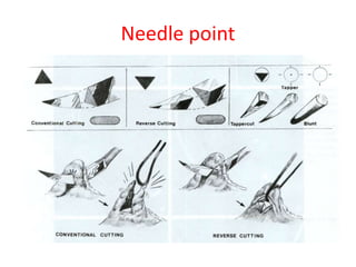 Needle point
 