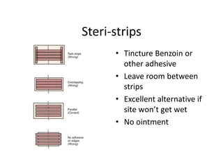 Steri-strips
• Tincture Benzoin or
other adhesive
• Leave room between
strips
• Excellent alternative if
site won’t get wet
• No ointment
 