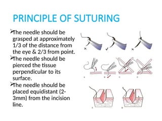 SUTURE AND SUTURING TECHNIQUES IN SURGERY | PPTX