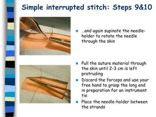 Simple interrupted stitch: Steps 9&10
 …and again supinate the needle-
holder to rotate the needle
through the skin
 Pull the suture material through
the skin until 2-3 cm is left
protruding
 Discard the forceps and use your
free hand to grasp the long end
in preparation for an instrument
tie
 Place the needle-holder between
the strands
 