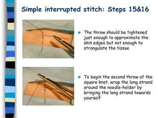 Simple interrupted stitch: Steps 15&16
 The throw should be tightened
just enough to approximate the
skin edges but not enough to
strangulate the tissue
 To begin the second throw of the
square knot, wrap the long strand
around the needle-holder by
bringing the long strand towards
yourself
 