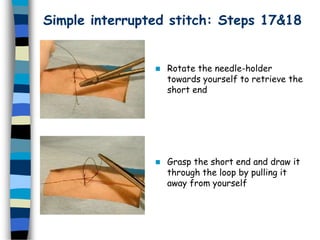 Simple interrupted stitch: Steps 17&18
 Rotate the needle-holder
towards yourself to retrieve the
short end
 Grasp the short end and draw it
through the loop by pulling it
away from yourself
 