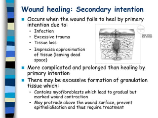 Wound healing: Secondary intention
 Occurs when the wound fails to heal by primary
intention due to:
– Infection
– Excessive trauma
– Tissue loss
 More complicated and prolonged than healing by
primary intention
 There may be excessive formation of granulation
tissue which:
– Contains myofibroblasts which lead to gradual but
marked wound contraction
– May protrude above the wound surface, prevent
epithelialisation and thus require treatment
– Imprecise approximation
of tissue (leaving dead
space)
 