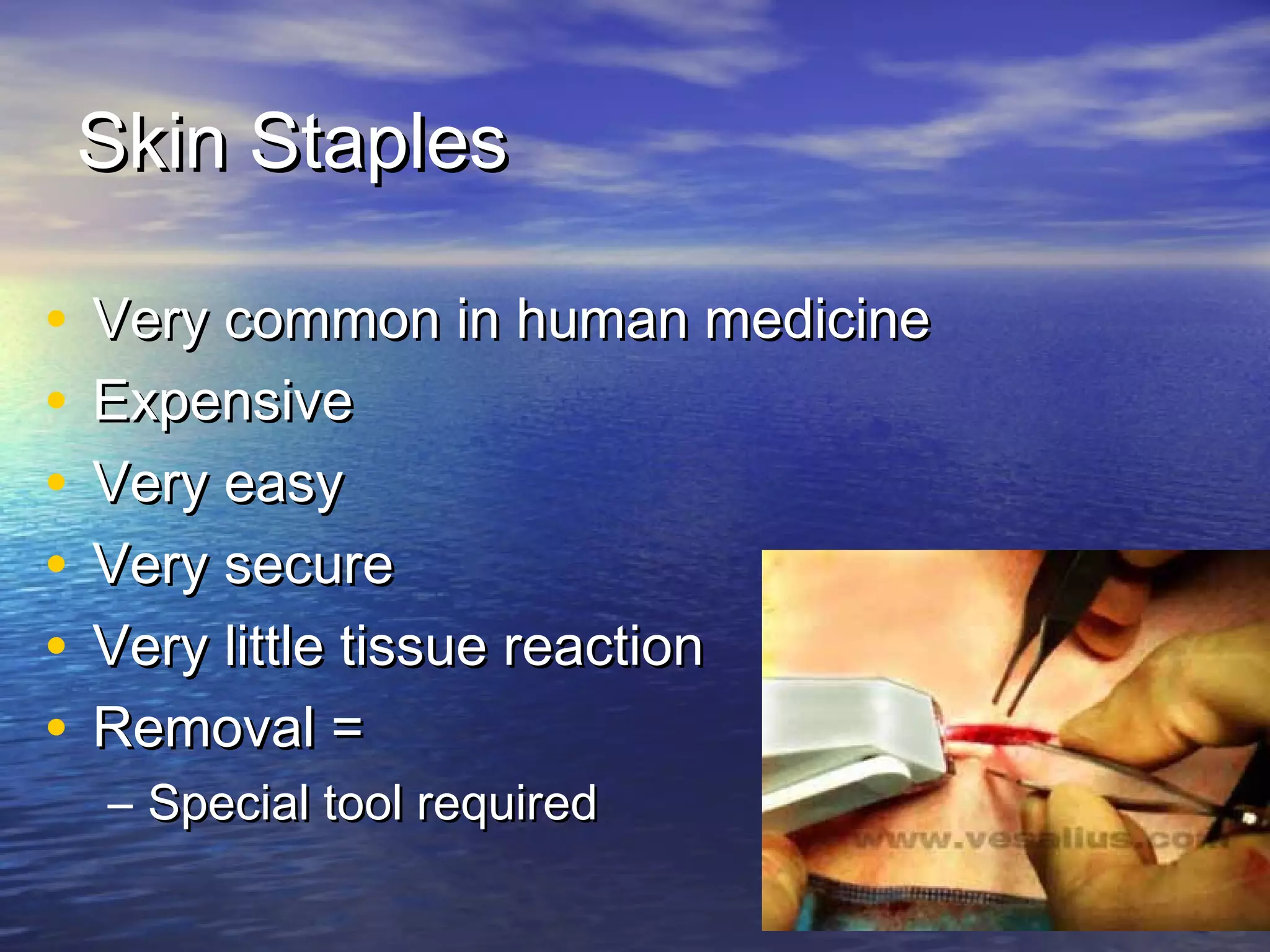 Skin StaplesSkin Staples
• Very common in human medicineVery common in human medicine
• ExpensiveExpensive
• Very easyVery easy
• Very secureVery secure
• Very little tissue reactionVery little tissue reaction
• Removal =Removal =
– Special tool requiredSpecial tool required
 