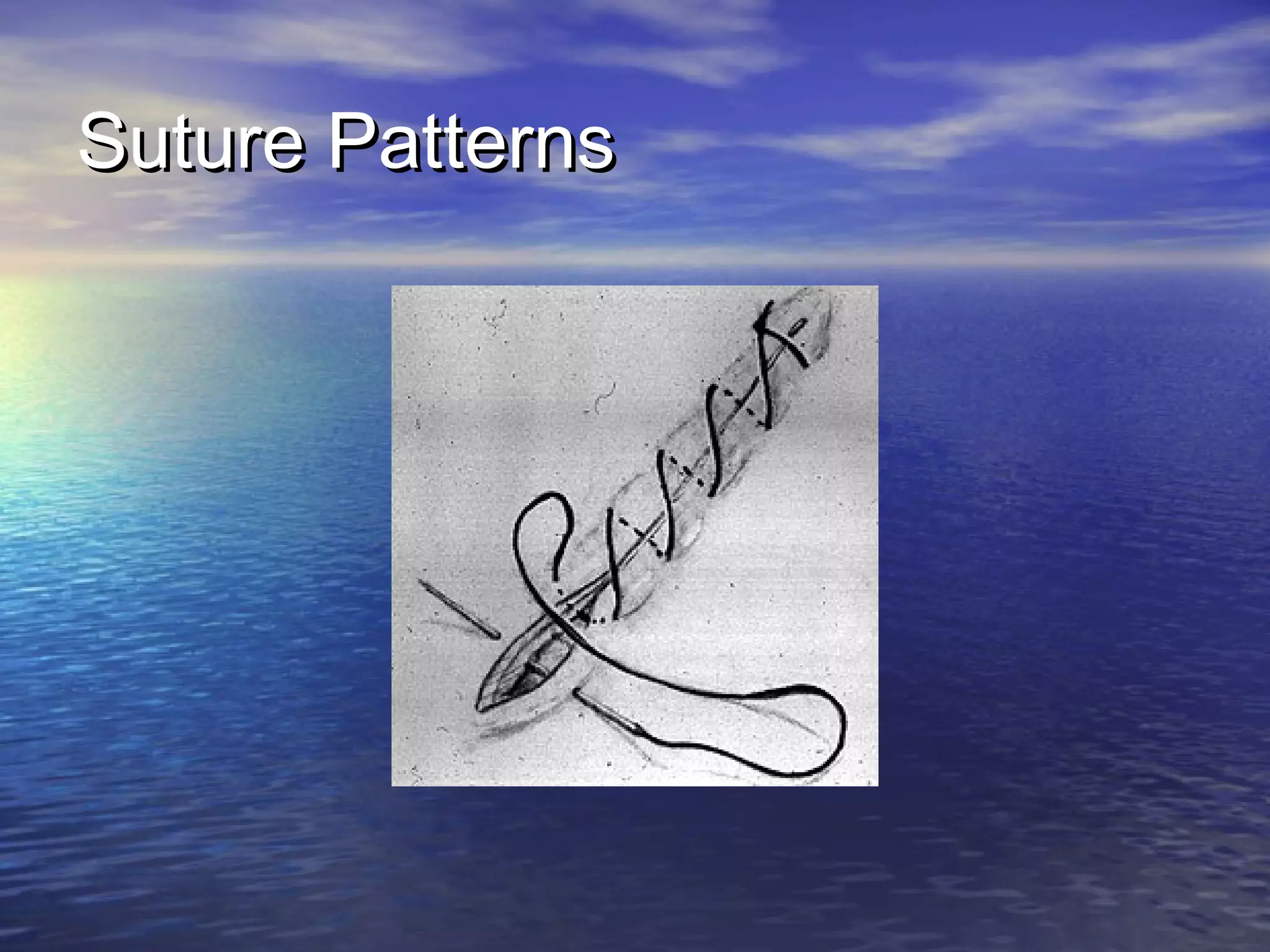 Suture PatternsSuture Patterns
 