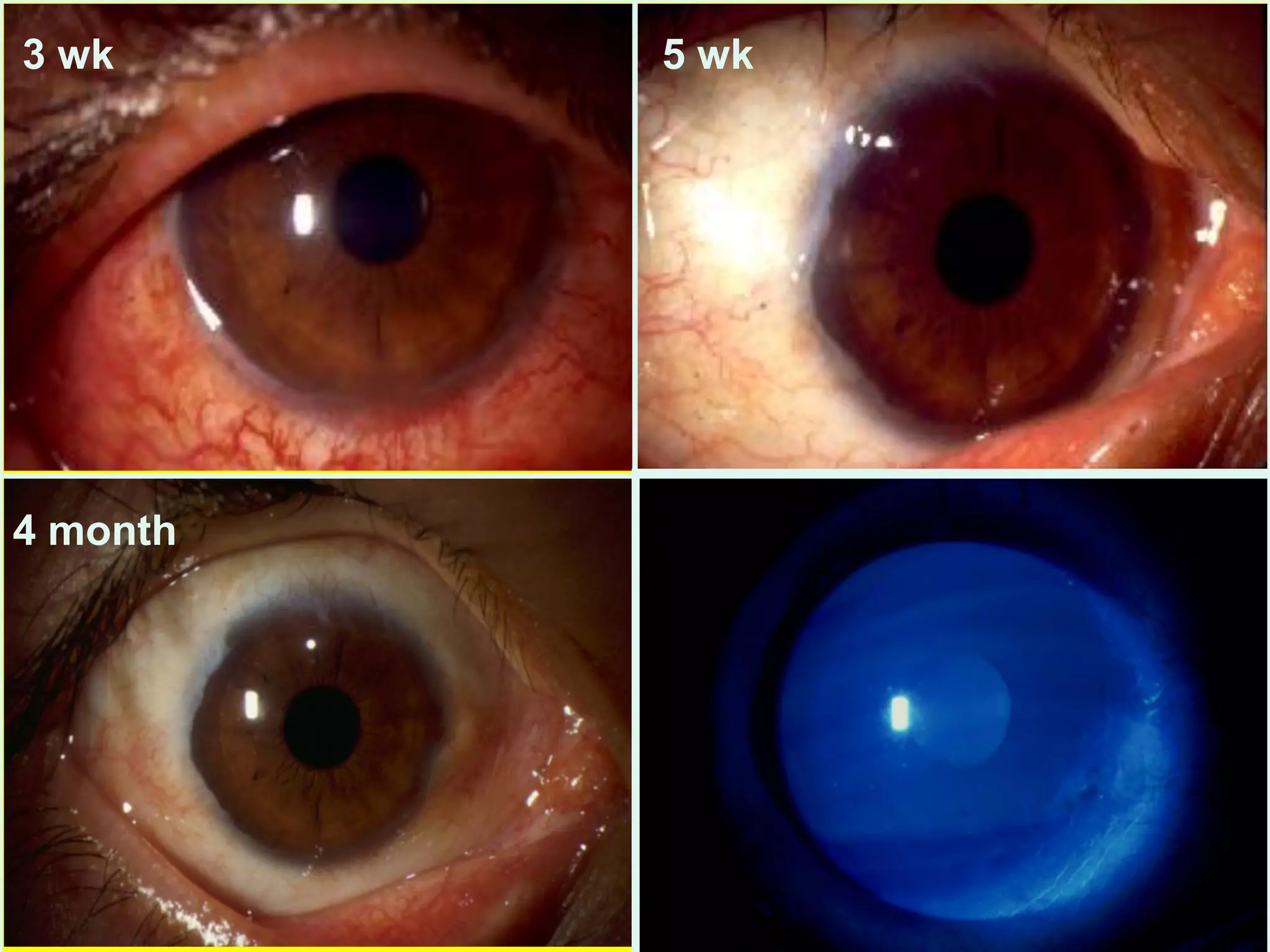 4 month
3 wk
5 wk
5 wk
 
