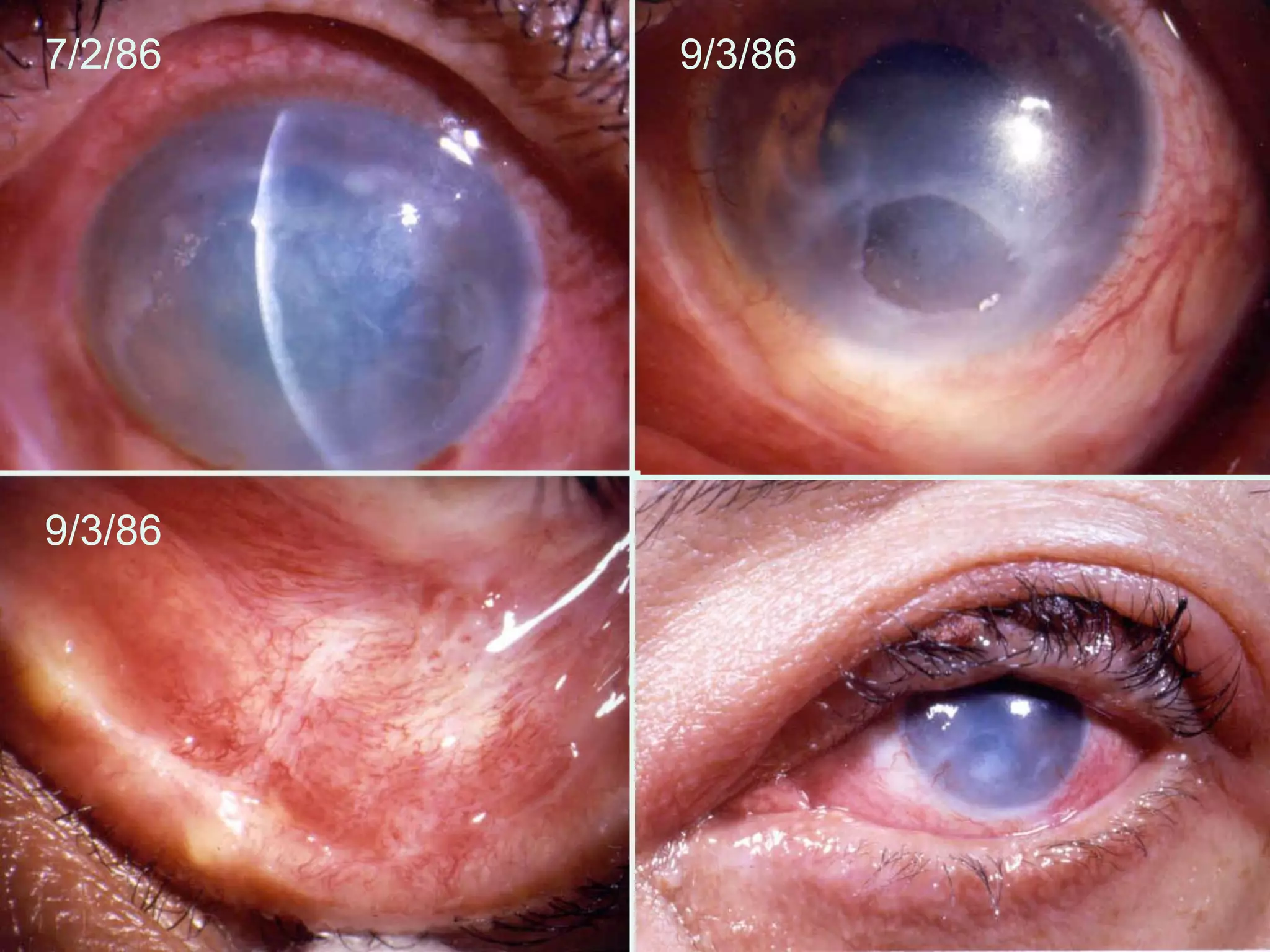 7/2/86 9/3/86
9/3/86
 