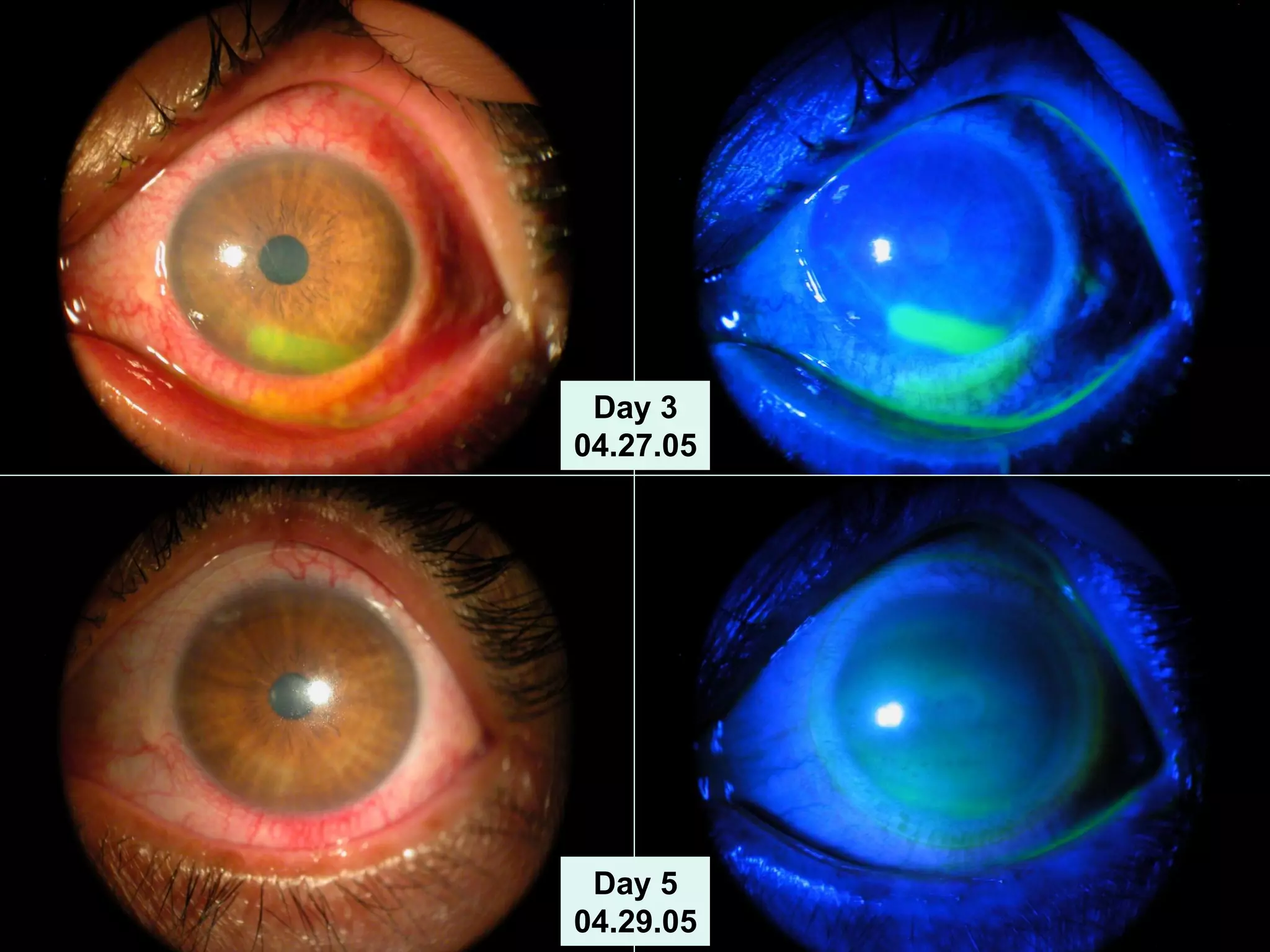 Day 3
04.27.05
OS
Day 5
04.29.05
 