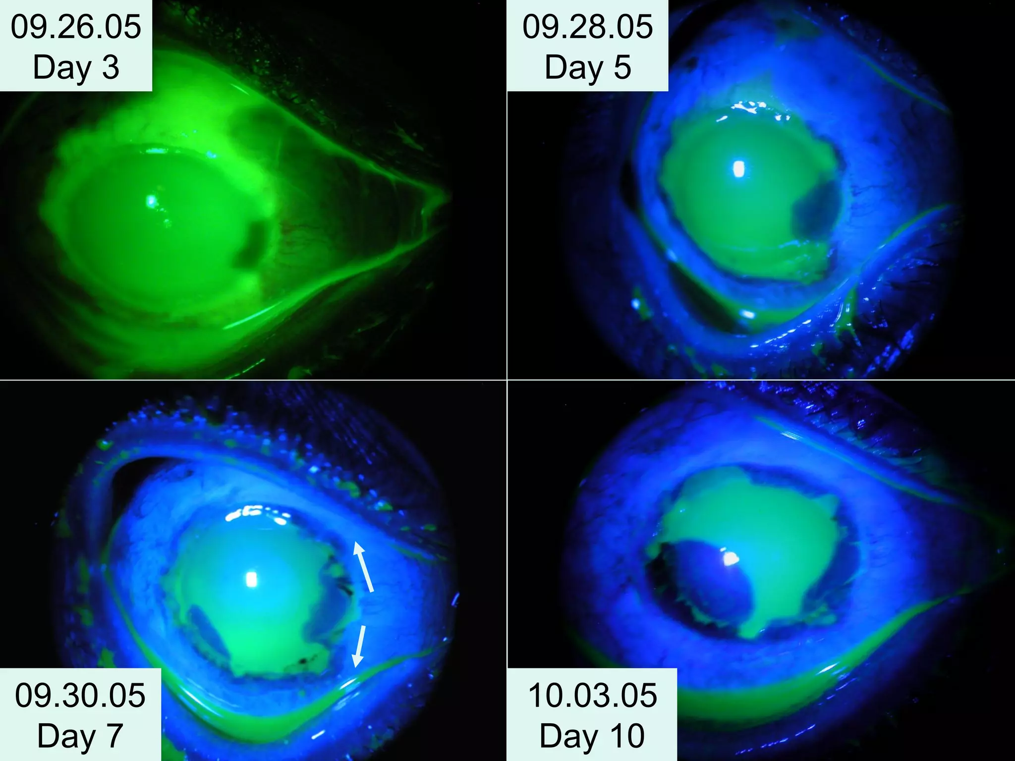 09.26.05
Day 3
09.28.05
Day 5
09.30.05
Day 7
10.03.05
Day 10
 