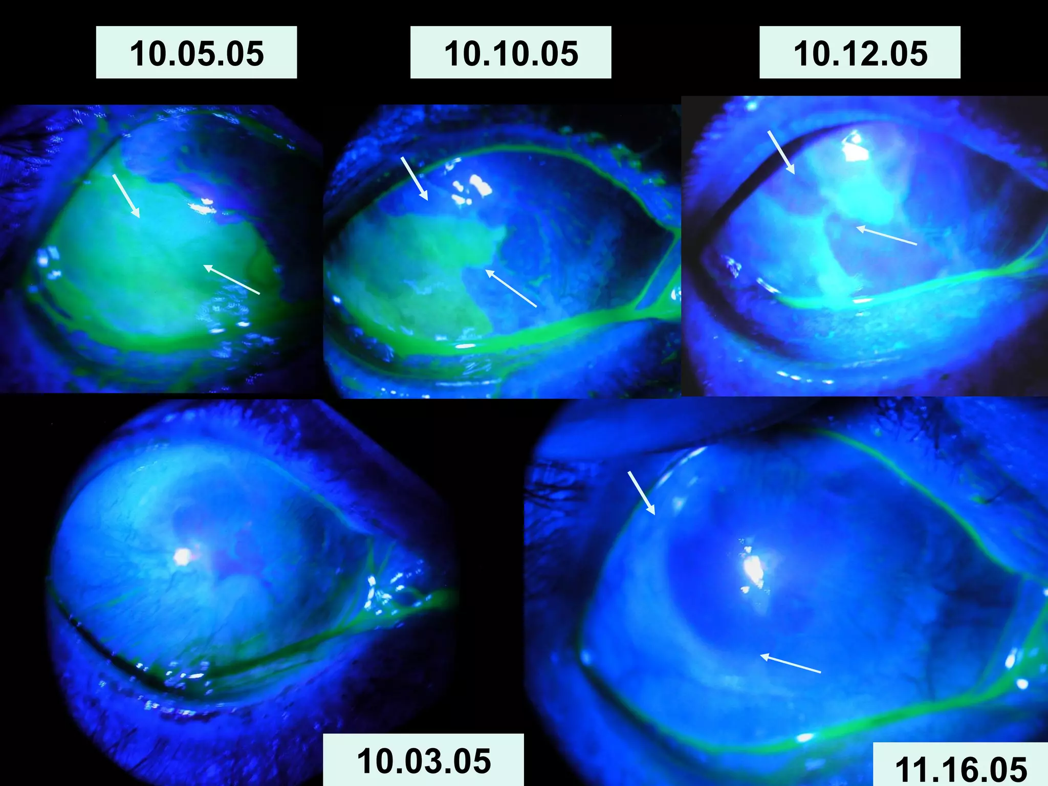 10.05.05
10.03.05
10.10.05 10.12.05
11.16.05
 