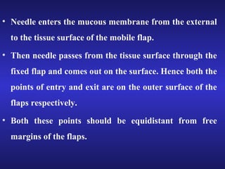 • Needle enters the mucous membrane from the external 
to the tissue surface of the mobile flap. 
• Then needle passes from the tissue surface through the 
fixed flap and comes out on the surface. Hence both the 
points of entry and exit are on the outer surface of the 
flaps respectively. 
• Both these points should be equidistant from free 
margins of the flaps. 
 