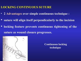 LOCKING CONTINUOUS SUTURE 
• 2 Advantages over simple continuous technique : 
 suture will align itself perpendicularly to the incision 
 locking feature prevents continuous tightening of the 
suture as wound closure progresses. 
Continuous locking 
technique 
 