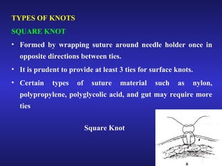 TYPES OF KNOTS 
SQUARE KNOT 
• Formed by wrapping suture around needle holder once in 
opposite directions between ties. 
• It is prudent to provide at least 3 ties for surface knots. 
• Certain types of suture material such as nylon, 
polypropylene, polyglycolic acid, and gut may require more 
ties 
Square Knot 
 
