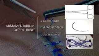 ARMAMENTARIUM
OF SUTURING
 Needle holder
 A suture needle
 Suture material
 