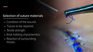  Condition of the wound.
 Tissues to be repaired.
 Tensile strength.
 Knot holding characteristics.
 Reaction of surrounding
tissues.
Selection of suture materials
 