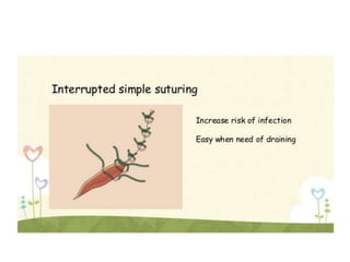 Suture Material.pptx