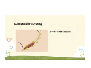 Suture Material.pptx