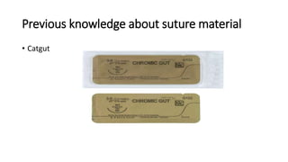 Previous knowledge about suture material
• Catgut
 