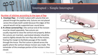 Suture materials and suturing techniques | PPTX