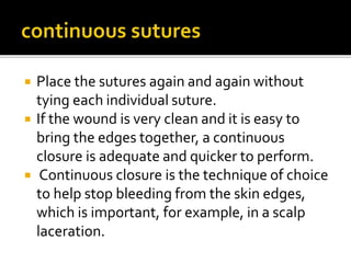  Place the sutures again and again without
tying each individual suture.
 If the wound is very clean and it is easy to
bring the edges together, a continuous
closure is adequate and quicker to perform.
 Continuous closure is the technique of choice
to help stop bleeding from the skin edges,
which is important, for example, in a scalp
laceration.
 