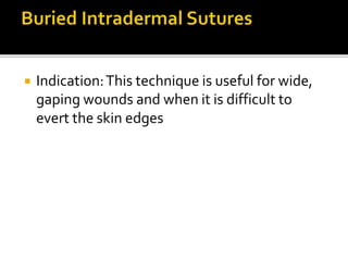  Indication:This technique is useful for wide,
gaping wounds and when it is difficult to
evert the skin edges
 