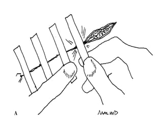 Suture materials and techniques