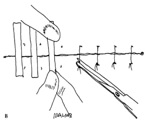 Suture materials and techniques