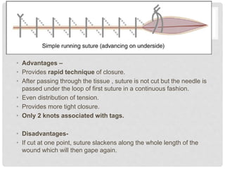 • Advantages –
• Provides rapid technique of closure.
• After passing through the tissue , suture is not cut but the needle is
passed under the loop of first suture in a continuous fashion.
• Even distribution of tension.
• Provides more tight closure.
• Only 2 knots associated with tags.
• Disadvantages-
• If cut at one point, suture slackens along the whole length of the
wound which will then gape again.
 