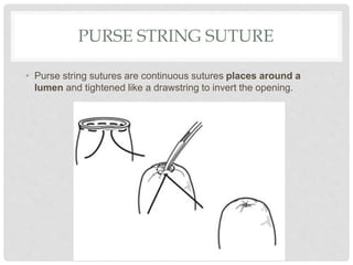 PURSE STRING SUTURE
• Purse string sutures are continuous sutures places around a
lumen and tightened like a drawstring to invert the opening.
 
