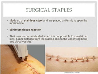 SURGICAL STAPLES
• Made up of stainless steel and are placed uniformly to span the
incision line.
• Minimum tissue reaction.
• Their use is contraindicated when it is not possible to maintain at
least 5 mm distance from the stapled skin to the underlying bone
and blood vessles.
 