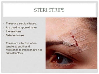 STERI STRIPS
• These are surgical tapes.
• Are used to approximate-
• Lacerations
• Skin incisions
• These are effective when
tensile strength and
resistance to infection are not
critical factors.
 