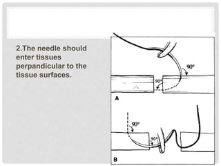 2.The needle should
enter tissues
perpandicular to the
tissue surfaces.
 