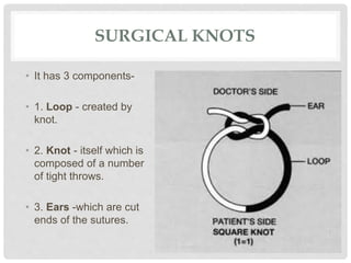 SURGICAL KNOTS
• It has 3 components-
• 1. Loop - created by
knot.
• 2. Knot - itself which is
composed of a number
of tight throws.
• 3. Ears -which are cut
ends of the sutures.
 