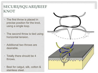 SECURE/SQUARE/REEF
KNOT
• The first throw is placed in
precise position for the knot,
using a single loop.
• The second throw is tied using
horizontal tension.
• Additional two throws are
desirable.
• Totally there should be 4
throws.
• Best for catgut, silk, cotton &
stainless steel.
 
