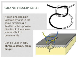 GRANNY’S/SLIP KNOT
• A tie in one direction
followed by a tie in the
same direction & a
third tie in the opposite
direction to the square
knot and hold it
permanently.
• Can be used in silk,
chromic catgut, plain
catgut.
 