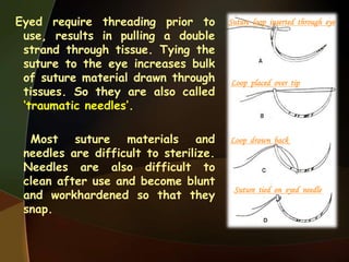 Eyed require threading prior to
use, results in pulling a double
strand through tissue. Tying the
suture to the eye increases bulk
of suture material drawn through
tissues. So they are also called
„traumatic needles‟.
Most suture materials and
needles are difficult to sterilize.
Needles are also difficult to
clean after use and become blunt
and workhardened so that they
snap.
Suture loop inserted through eye
Loop placed over tip
Loop drawn back
Suture tied on eyed needle
 