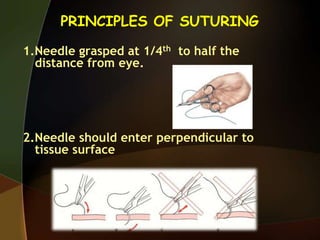 PRINCIPLES OF SUTURING
1.Needle grasped at 1/4th to half the
distance from eye.
2.Needle should enter perpendicular to
tissue surface
 
